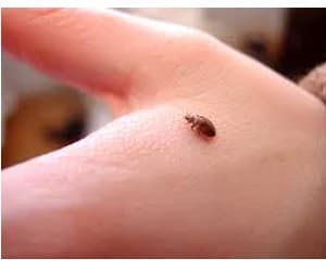 Close-up of a bed bug on a person's hand showing its size relative to human skin